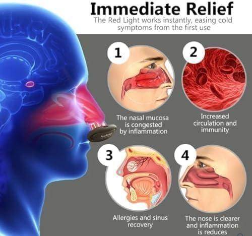 Portable Infrared Rhinitis Device - SmartPursue™