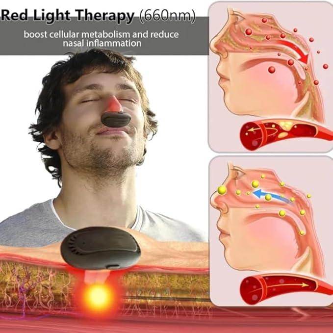 Portable Infrared Rhinitis Device - SmartPursue™