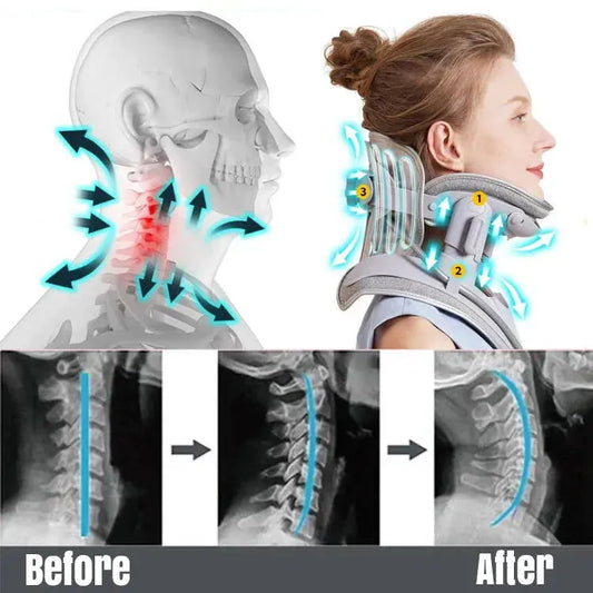 Cervical Traction Neck Brace Neck Traction Device - SmartFusion™